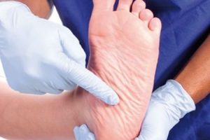 Implementarea serviciilor de podiatrie scade incidența primei ulcerații a piciorului diabetic