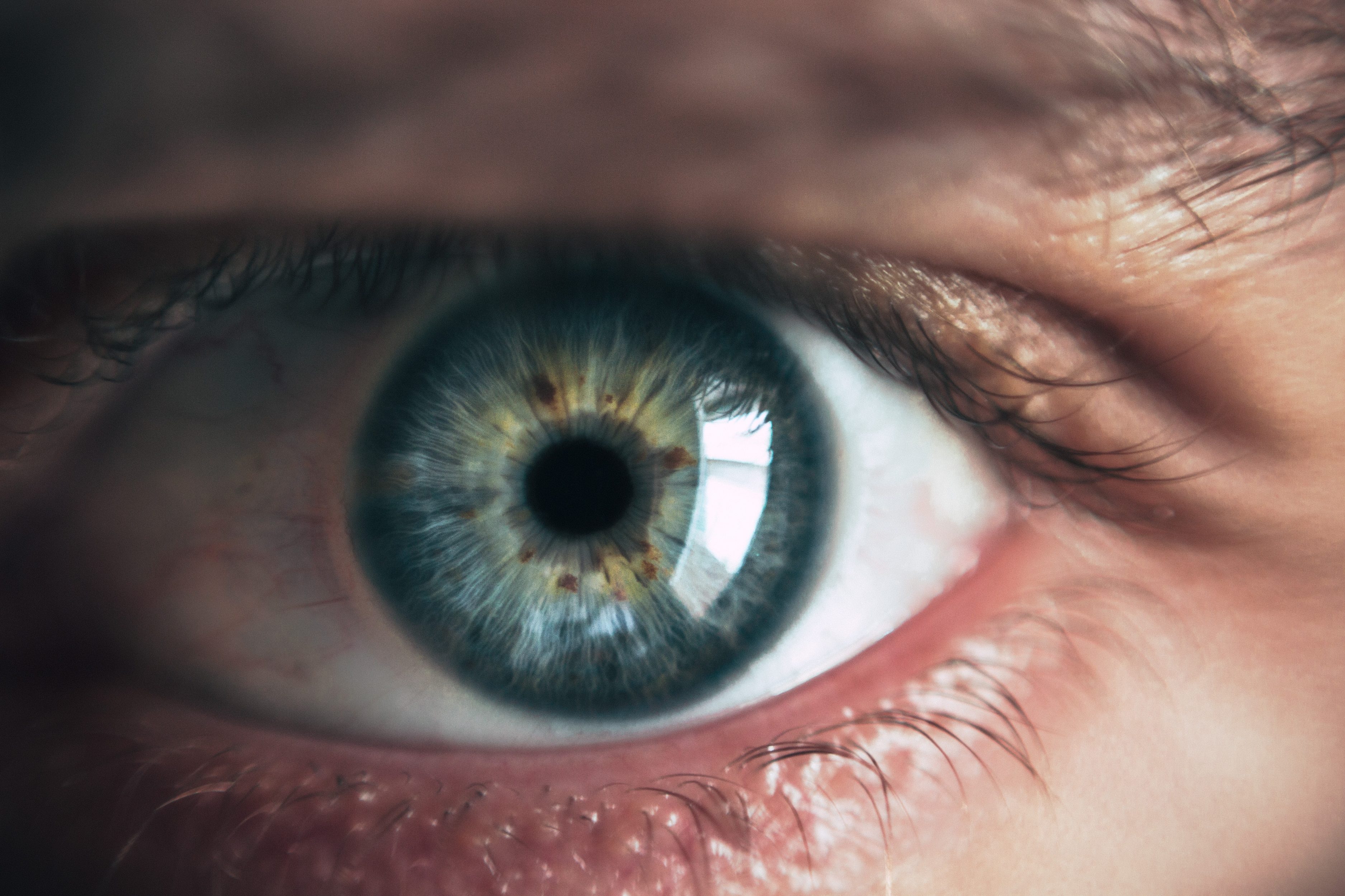 Retinopatia: Cum afectează diabetul vederea