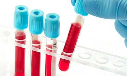 Teste de sânge pentru pacientul diabetic